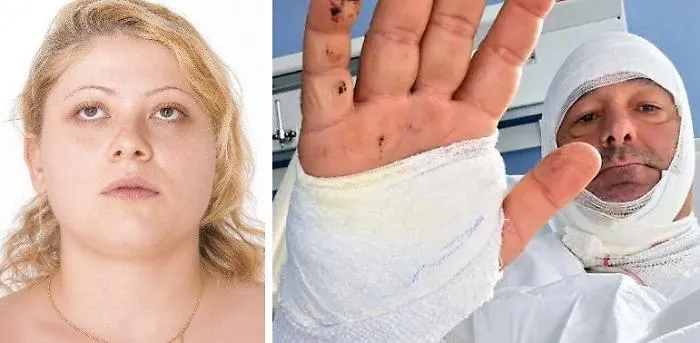 Getta liquido corrosivo all'avvocato: il gip convalida il fermo dell'indagato 
